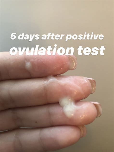 discharge 4dpo|watery cervical mucus after ovulation.